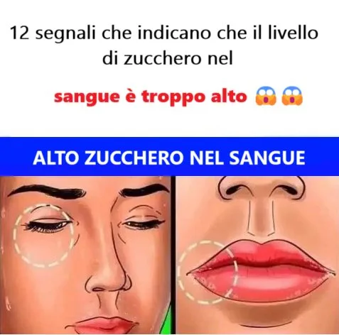 12 segnali che indicano che il livello di zucchero nel sangue è troppo alto